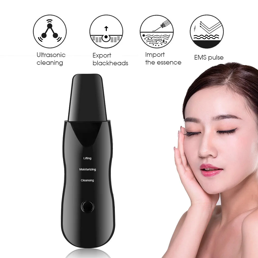 Espátula Facial Ultrassônica-Remove Cravos e Limpa Poros Profundamente
