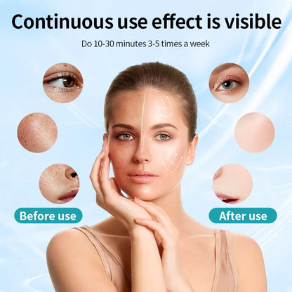 Máscara LED 7 Cores UBilli - Fototerapia Anti-Idade Profissional